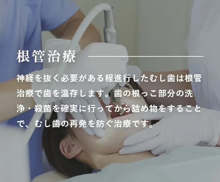 根管治療 神経を抜く必要がある程進行したむし歯は根管治療で歯を温存します。歯の根っこ部分の洗浄・殺菌を確実に行ってから詰め物をすることで、むし歯の再発を防ぐ治療です。